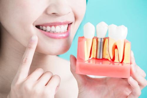 chirurgie des dents tunisie