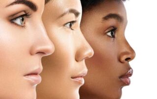 rhinoplastie ethnique