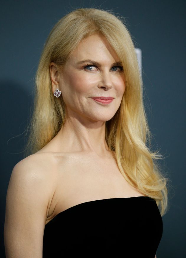 Nicole Kidman avant et après la chirurgie esthétique