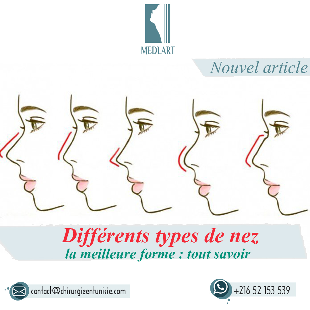 différents types de nez
